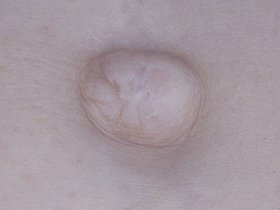 300人のへそ 2　サンプル画像04